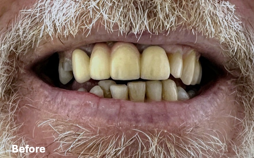 Tomas, before treatment